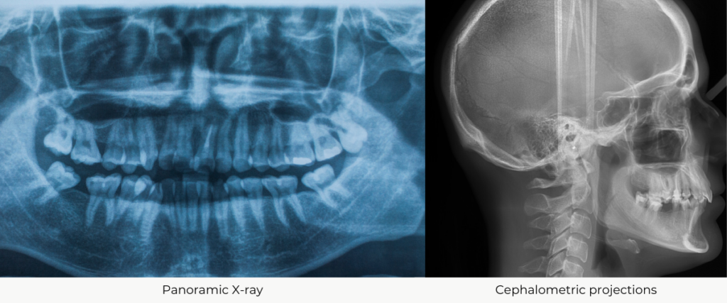 Panoramic X-ray | Cephalometric projections | Dental X-rays